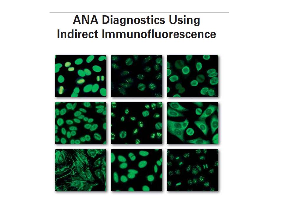 تشخیص الگوهای آزمایش ANA با تکنولوژی ایمونوفلورسانس غیر مستقیمIIFT (بخش اول)