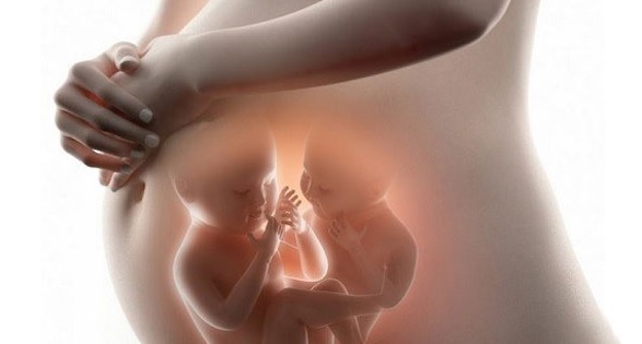 آزمایش NIPT در حاملگی های دوقلو