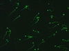 نحوه تشکیل ،نقش و تشخیص  (Anti Sperm Antibody(ASA در ناباروری