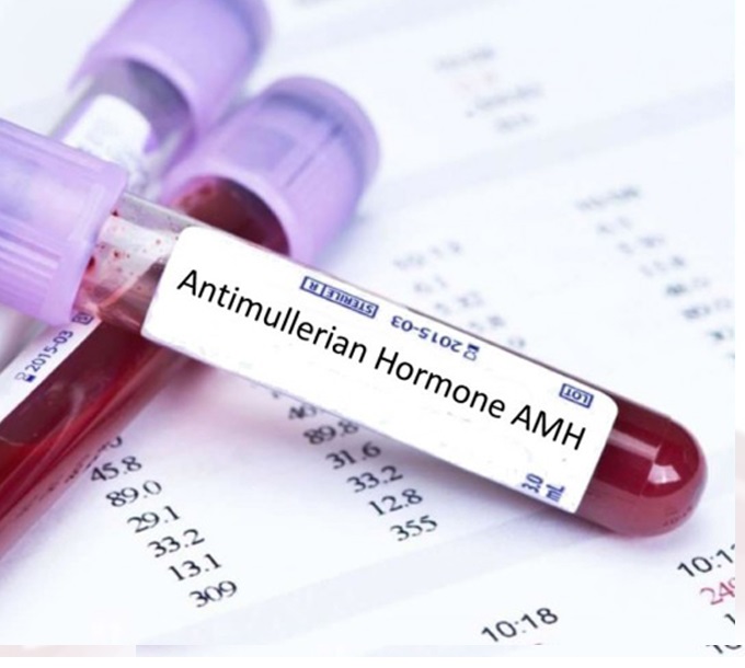 آزمایش آنتی مولرین هورمون (AMH)