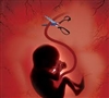 دلایل سقط جنین غیر ارادی 